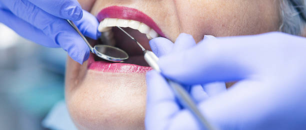 Best Emergency Root Canal Treatment in New Albany, OH